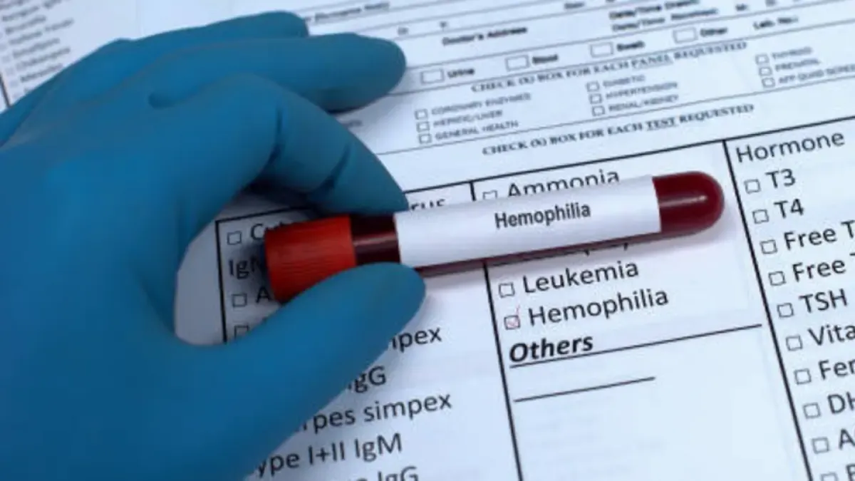 Medical guild alerts about barriers in access to medicines for children with hemophilia in Colombia